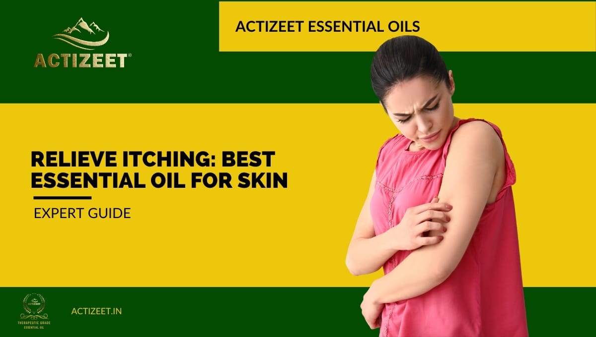 what essential oil is good for itching skin