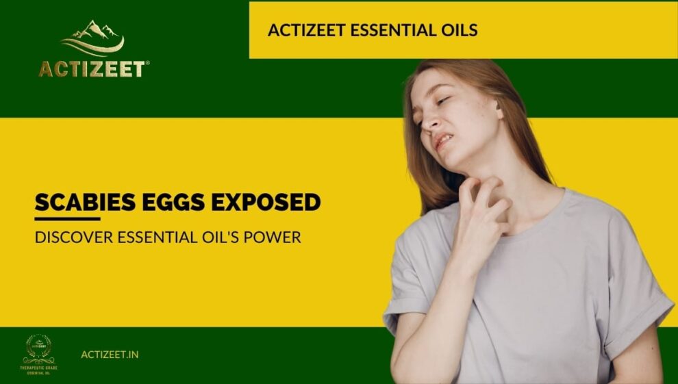 Scabies Eggs Exposed Discover Essential Oil's Power