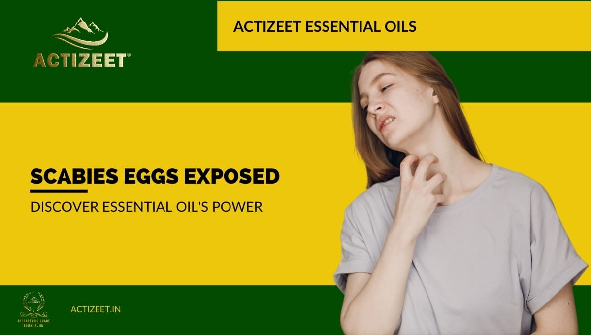 what essential oil kills scabies eggs