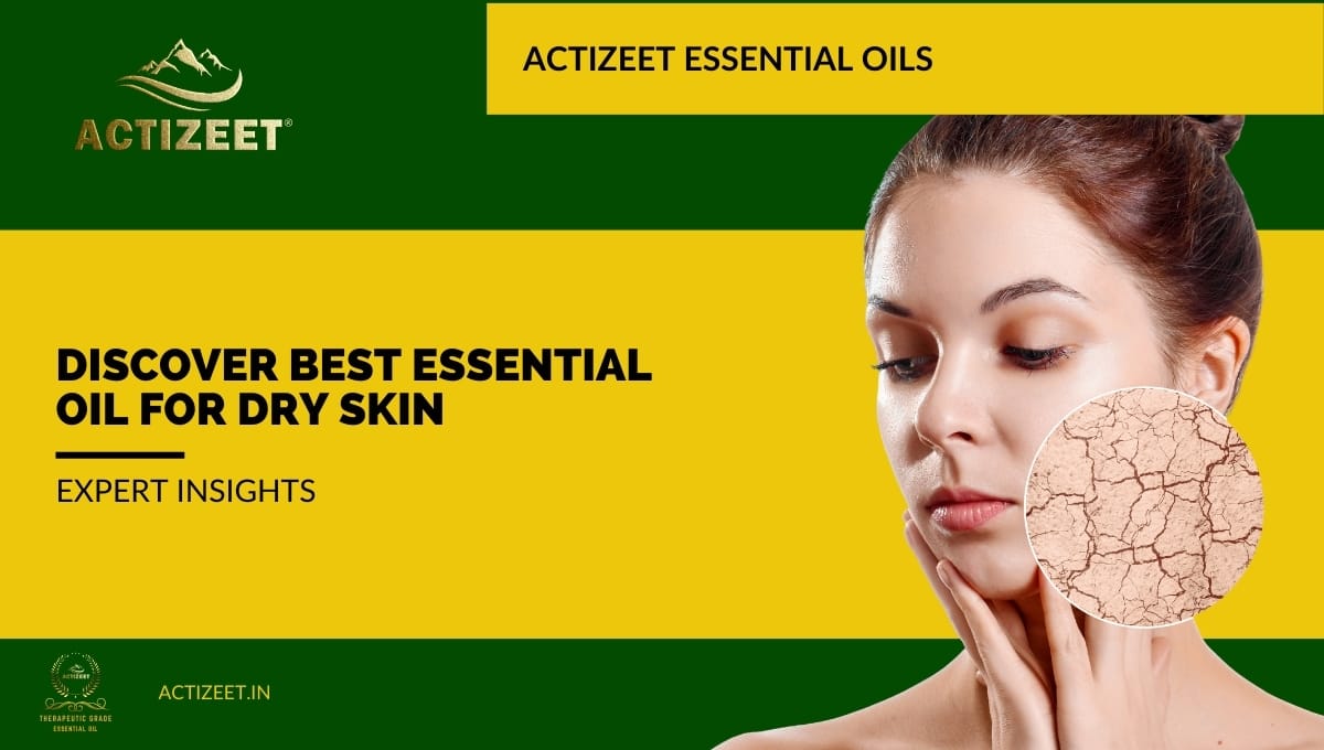 which essential oil is good for dry skin?