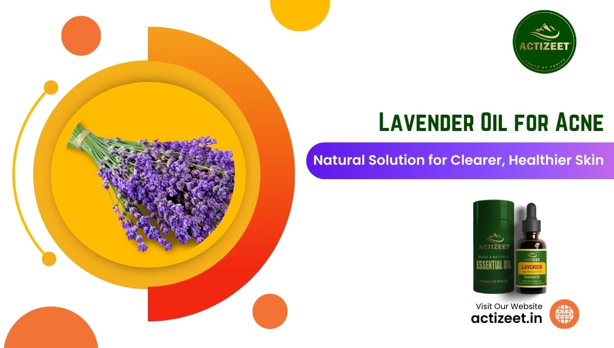 Lavender Oil for Acne